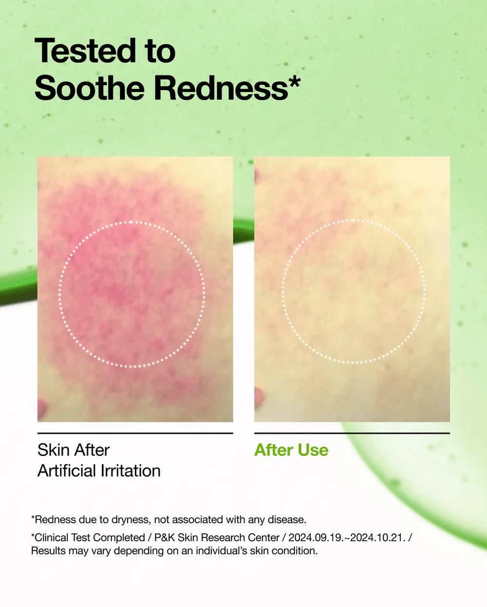 anua-us-ampoule-serum-azelaic-acid-10-hyaluron-redness-soothing-serum-1142993317